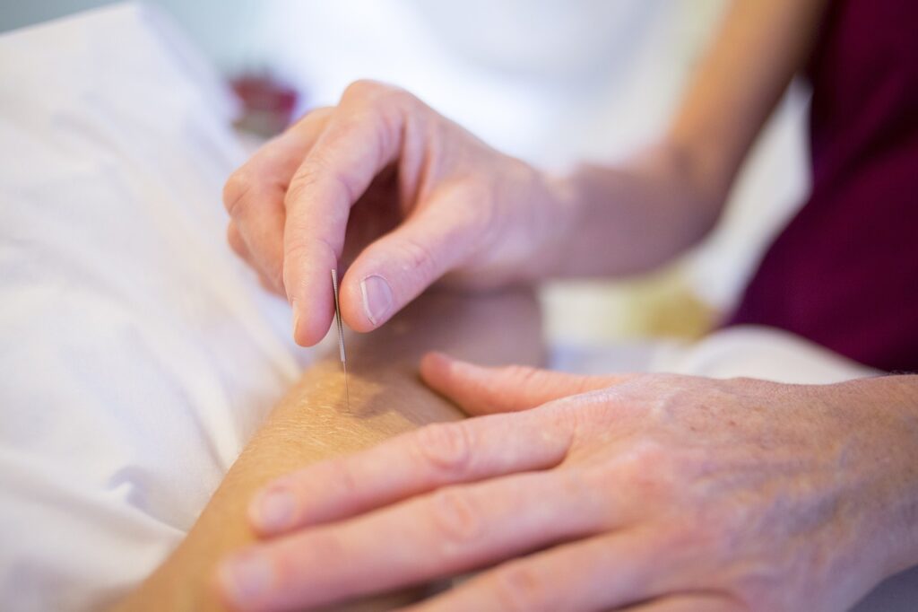 acupuncture-holistic-healing-holistic-