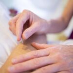 acupuncture-holistic-healing-holistic-